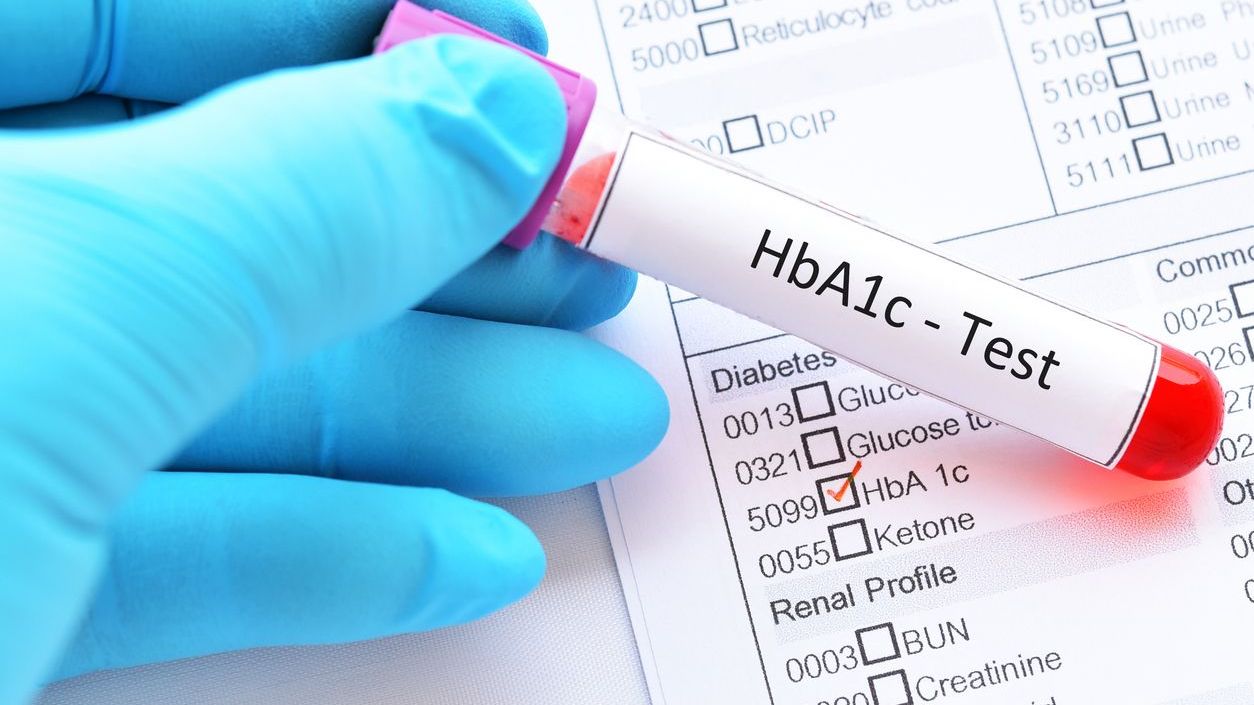 HbA1c test for diabetes diagnosis. (iStock)