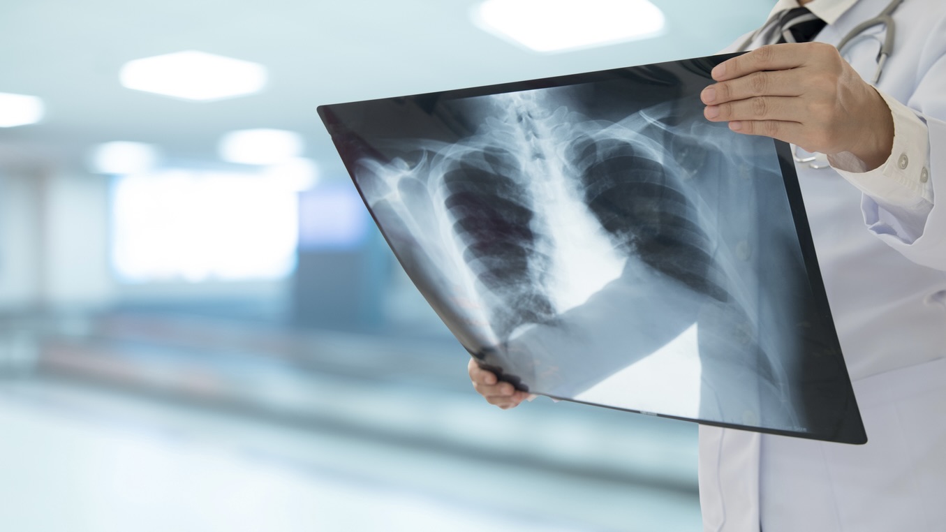 ICMR promoted a ‘Make in India’ handheld TB device; it used core parts imported from China