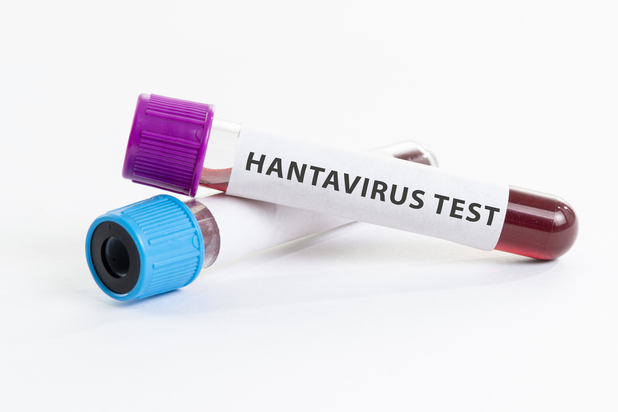 Hantavirus.