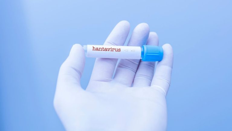 Hantavirus
