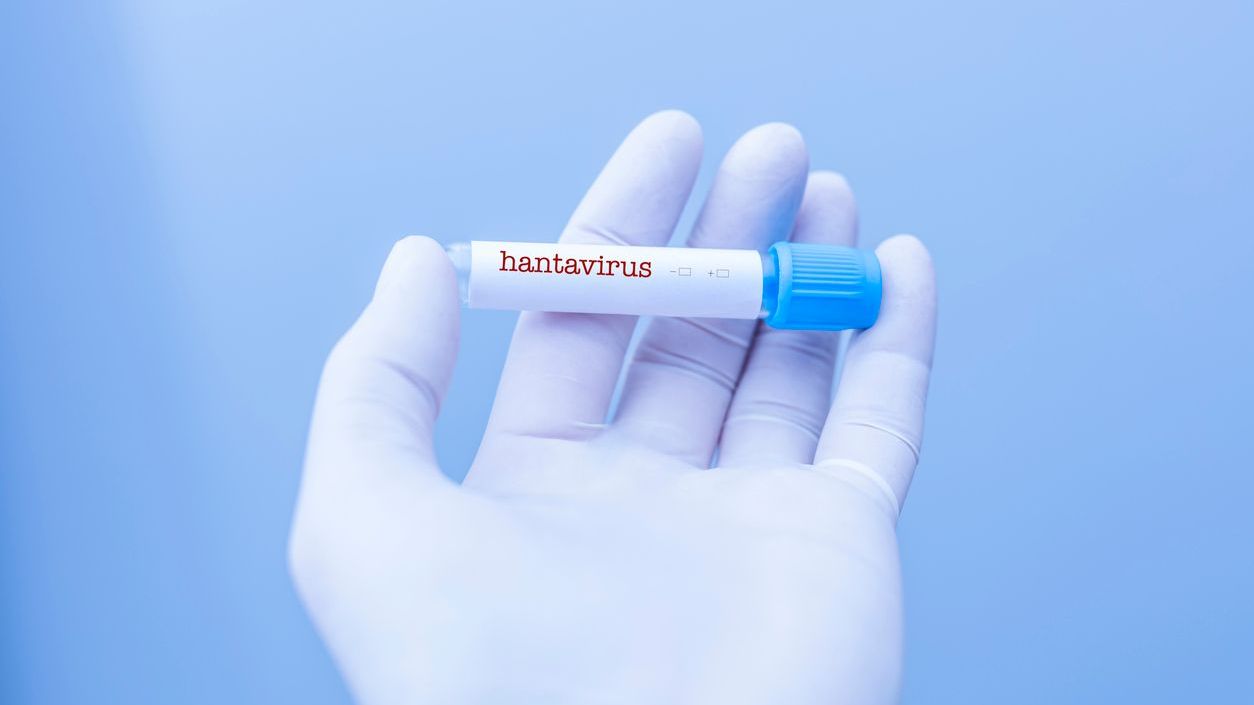 Hantavirus