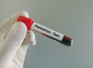 Two Indian crew members quarantined after Hantavirus scare on cruise ship near Spain