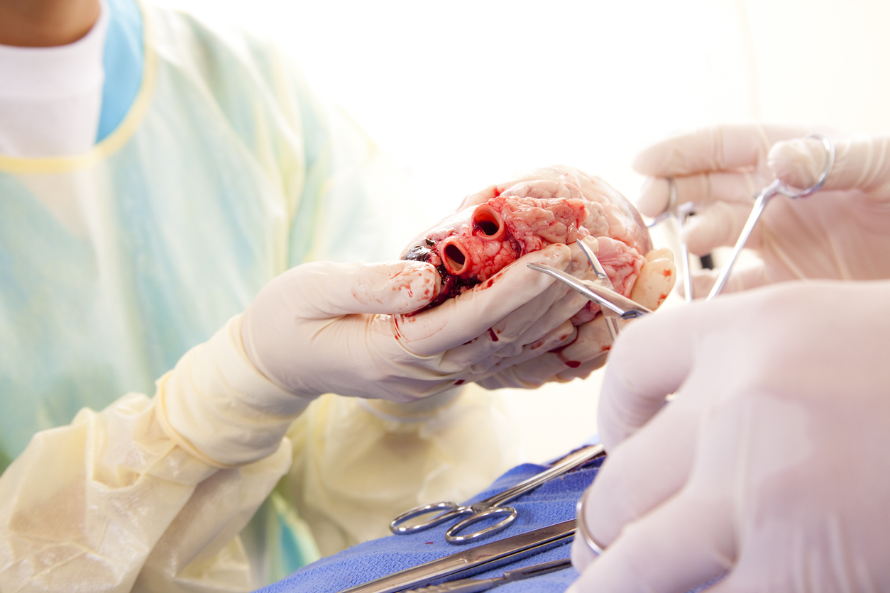 The procedure involved transplanting the stomach, duodenum, pancreas, small bowel and right colon into a 30-year-old engineer from Sircilla.
