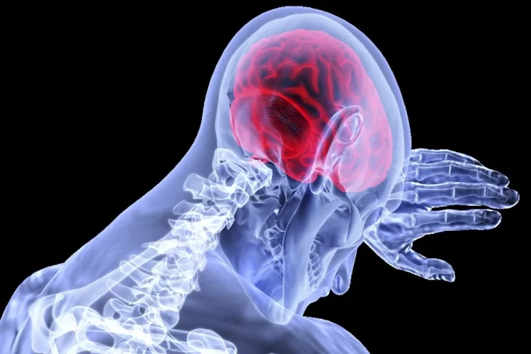 CVT-related stroke predominantly affects young males in India. (Supplied)