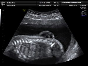 A parliamentary panel wants six-month-trained doctors to perform ultrasounds. Impossible, say radiologists