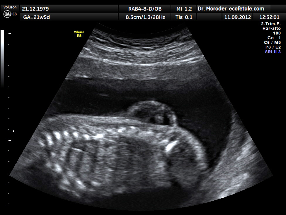A parliamentary panel wants six-month-trained doctors to perform ultrasounds. Impossible, say radiologists