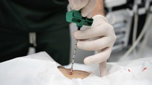Bone marrow transplant: How half-match donors are expanding options for children in India