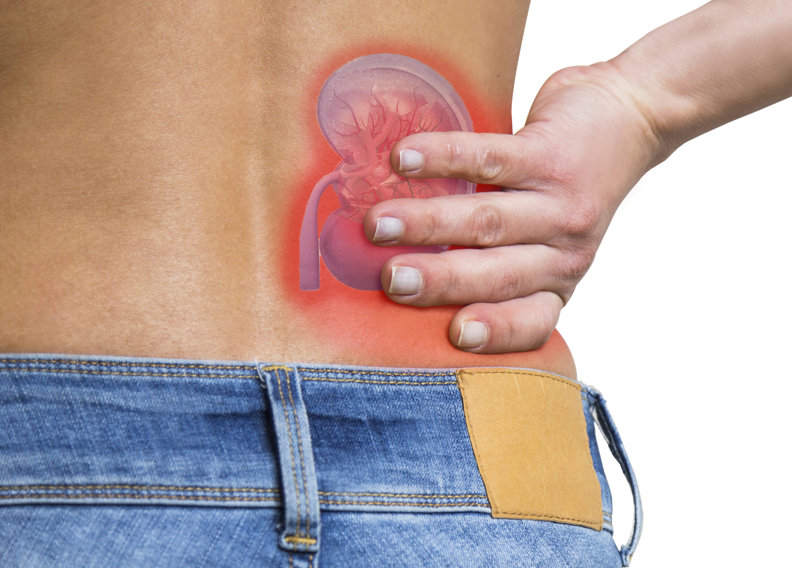 Patients often failed to connect their symptoms to kidney disease.