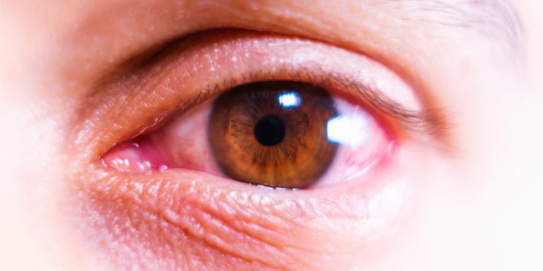 eye donation