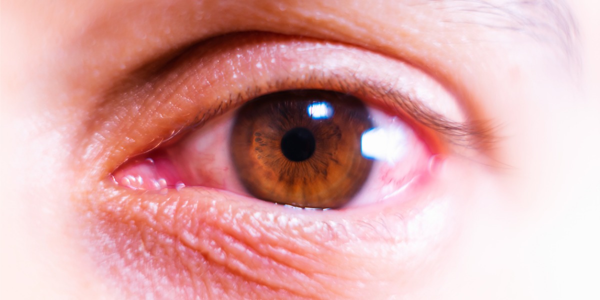 eye donation