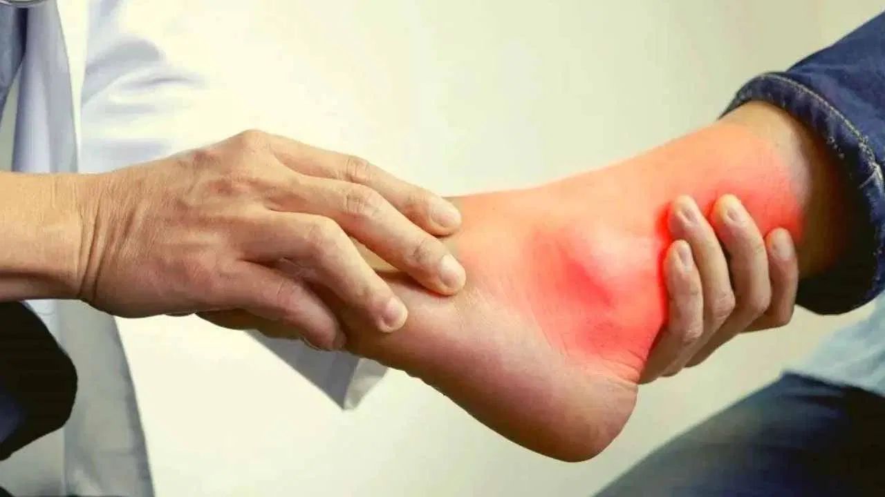 Uric acid : ఇలా చేస్తే యూరిక్ యాసిడ్ తగ్గడం ఖాయం Uric acid : ఇలా చేస్తే యూరిక్ యాసిడ్ తగ్గడం ఖాయం