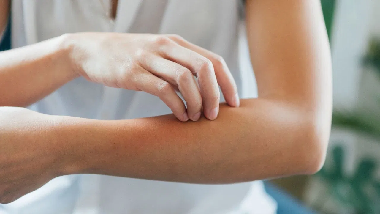 Skincare : వానాకాలంలో స్కిన్ అలర్జీలు, ఫంగల్ ఇన్ఫెక్షన్లు నుంచి రక్షించుకునే చిట్కాలివే! Skincare : వానాకాలంలో స్కిన్ అలర్జీలు, ఫంగల్ ఇన్ఫెక్షన్లు నుంచి రక్షించుకునే చిట్కాలివే!