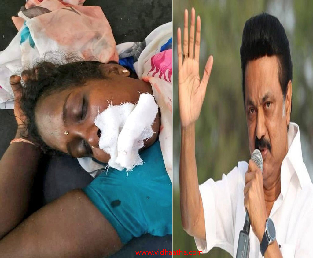 స్టాలిన్ కోసం.. నాలుక కోసుకున్న మహిళ స్టాలిన్ కోసం.. నాలుక కోసుకున్న మహిళ