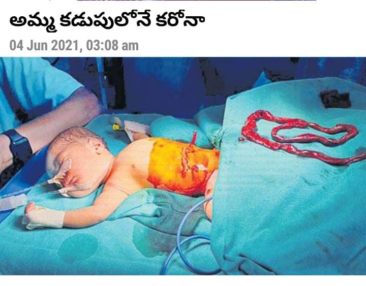 అమ్మ కడుపులోనే కరోనా అమ్మ కడుపులోనే కరోనా