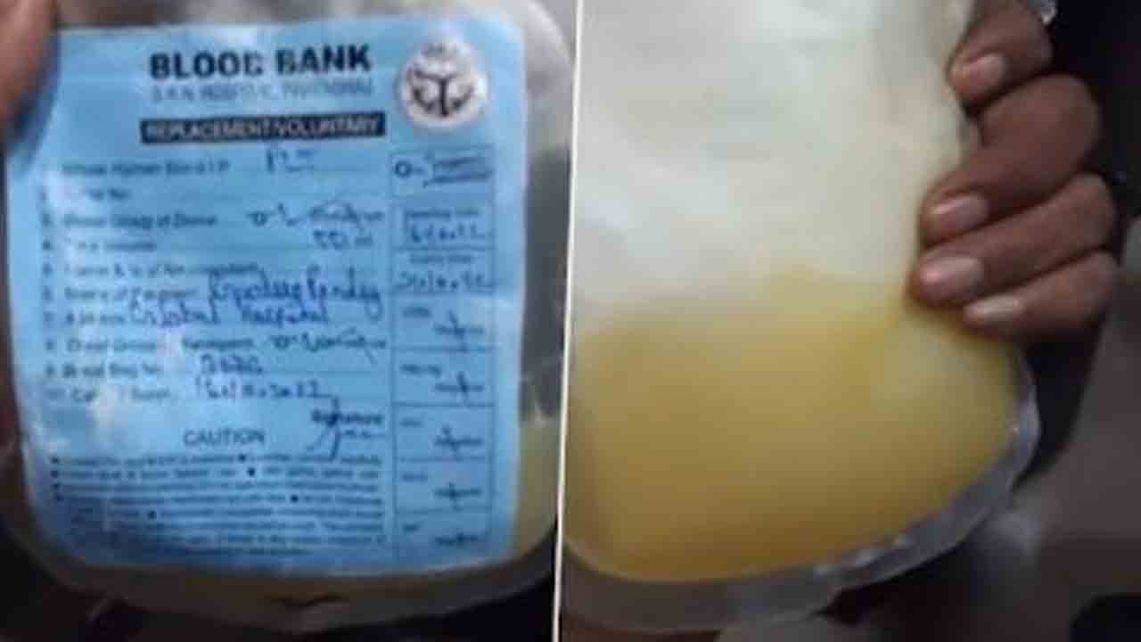 బ్లడ్ ప్లాస్మాకు బదులు మోసంబి(బత్తాయి) జ్యూస్ ఎక్కించారు.. డెంగీ రోగి మృతి బ్లడ్ ప్లాస్మాకు బదులు మోసంబి(బత్తాయి) జ్యూస్ ఎక్కించారు.. డెంగీ రోగి మృతి
