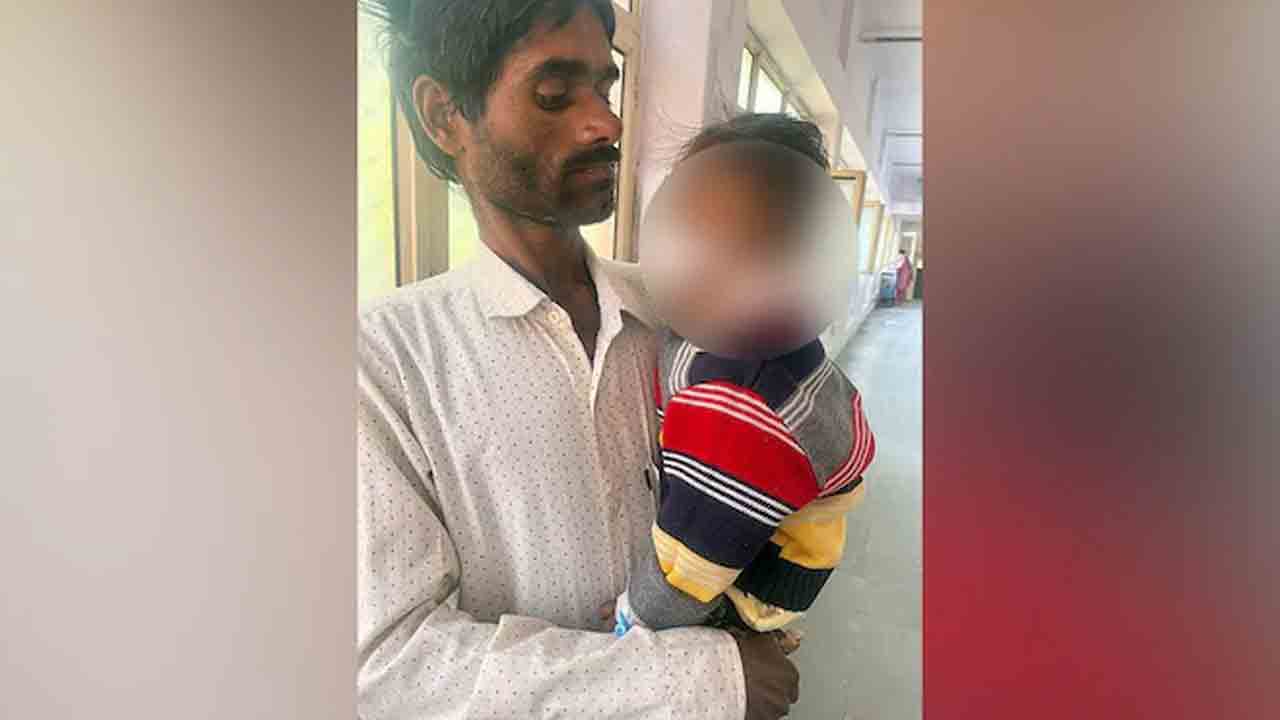 వీధి కుక్క దాడి.. ఏడాది పసిబిడ్డ ముఖంపై 60 కుట్లు వీధి కుక్క దాడి.. ఏడాది పసిబిడ్డ ముఖంపై 60 కుట్లు