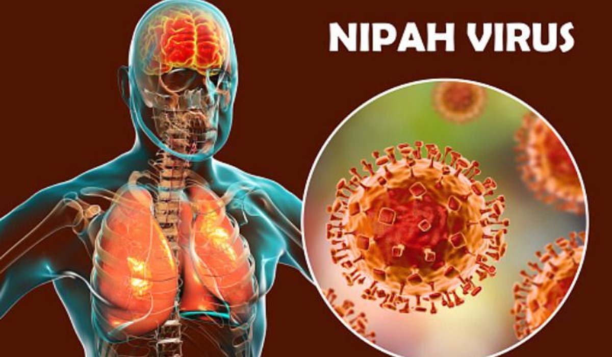 Nipah Virus | కలకలం సృష్టిస్తున్న నిపా..! వైరస్ లక్షణాలు ఎలా ఉంటాయ్..? చికిత్స ఏంటంటే..? Nipah Virus | కలకలం సృష్టిస్తున్న నిపా..! వైరస్ లక్షణాలు ఎలా ఉంటాయ్..? చికిత్స ఏంటంటే..?