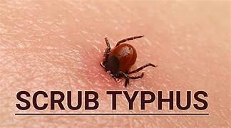 Scrub typhus | ఒడిస్సాను వణికిస్తున్న స్క్రబ్ టైఫస్.. మరో 11కేసుల గుర్తింపు Scrub typhus | ఒడిస్సాను వణికిస్తున్న స్క్రబ్ టైఫస్.. మరో 11కేసుల గుర్తింపు