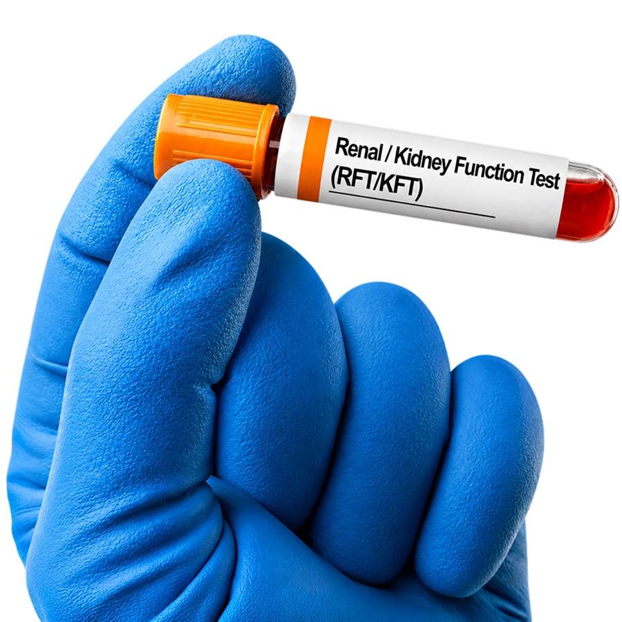 Renal / Kidney Function Test (RFT / KFT)