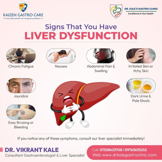 Understanding Alcoholic Liver Disease: Signs, Symptoms, and Treatment