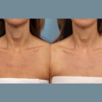Premium Care from Moxi Laser Treatment Best Doctors in Dubai