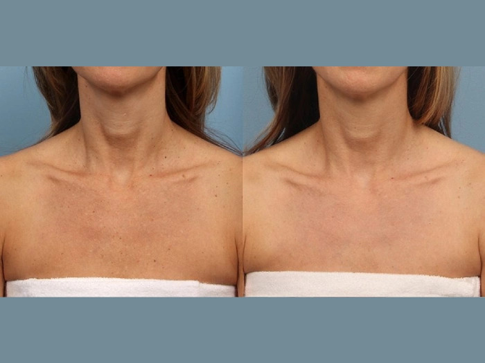 Premium Care from Moxi Laser Treatment Best Doctors in Dubai