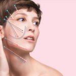 Achieve Firmer, Tighter Skin with Thread Lift in Dubai