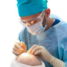 Make Yourself Look Beautiful with FUE Hair Transplant in Delhi Experience the Art of Natural Restoration