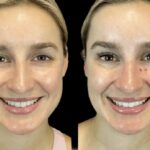 Combining Treatments Safely: Advice from the Best Aesthetic Clinic in Dubai