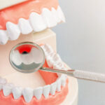 Professional Periodontal Disease Treatment in Converse, TX for Lasting Results