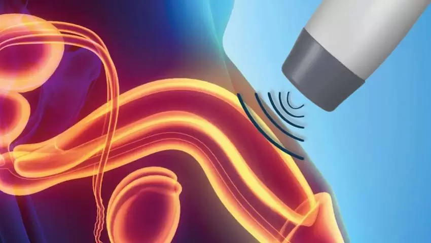 Shockwave Therapy for Erectile Dysfunction in Pune – A Modern, Effective Treatment by Dr. Akhil S. Mane