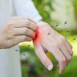 Mosquitoes Control Trusted Easy Fix for a Peaceful Home