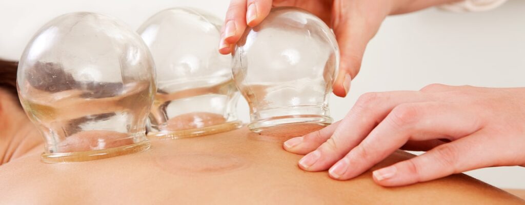 Unlock Faster Muscle Recovery with Cupping Massage