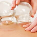 Unlock Faster Muscle Recovery with Cupping Massage