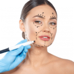 What to Expect During a Facial Thread Lift in Dubai Treatment