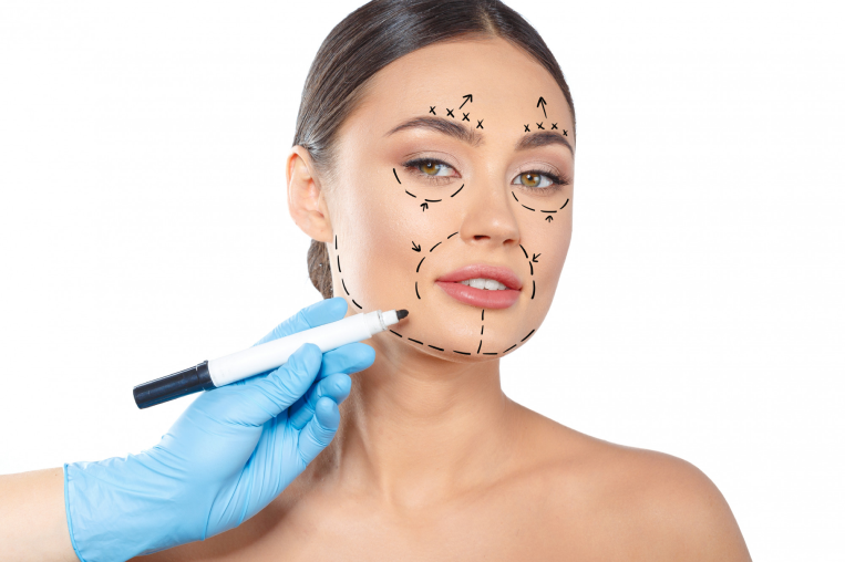 What to Expect During a Facial Thread Lift in Dubai Treatment