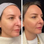 Best Aesthetic Clinics in Dubai – Best Places for Mesotherapy