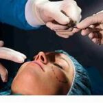 Plastic Surgery Nurse After Care: The Essential Partner in a Safe and Confident Recovery