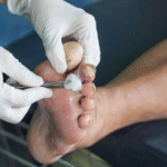 Personalized Mobile Diabetes & Foot Health Solutions in Edmonton