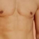 أحدث تقنيات شفط الدهون في جدة لنحت الجسم بدقة ونتائج ملحوظة