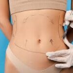 Why Liposuction Surgery in Dubai Is a Top Choice for Body Reshaping