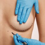 Breast Lift in Dubai: Common Reasons Women Choose This Procedure