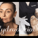 Hydrafacial Treatment at The Medispa – The Modern Skincare Experience