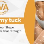 Bodies Change for Reasons, Not Failures: Delhi’s New Understanding of Tummy Tuck