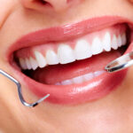 Dental Tooth Filling Dubai – Advanced Solutions for Stronger Teeth