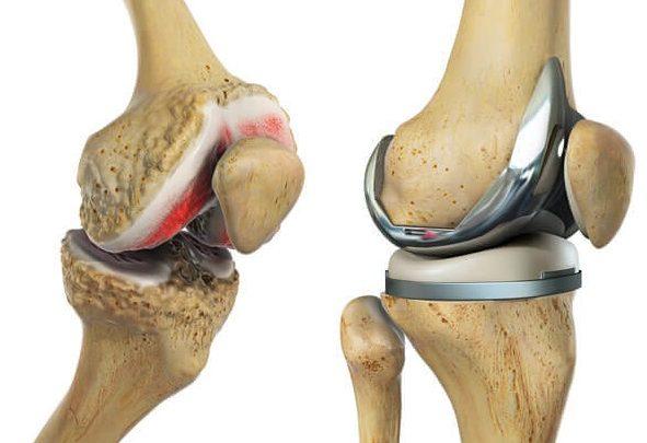 Ligament Injury Treatment in Jaipur: Causes, Symptoms & Best Treatment Options