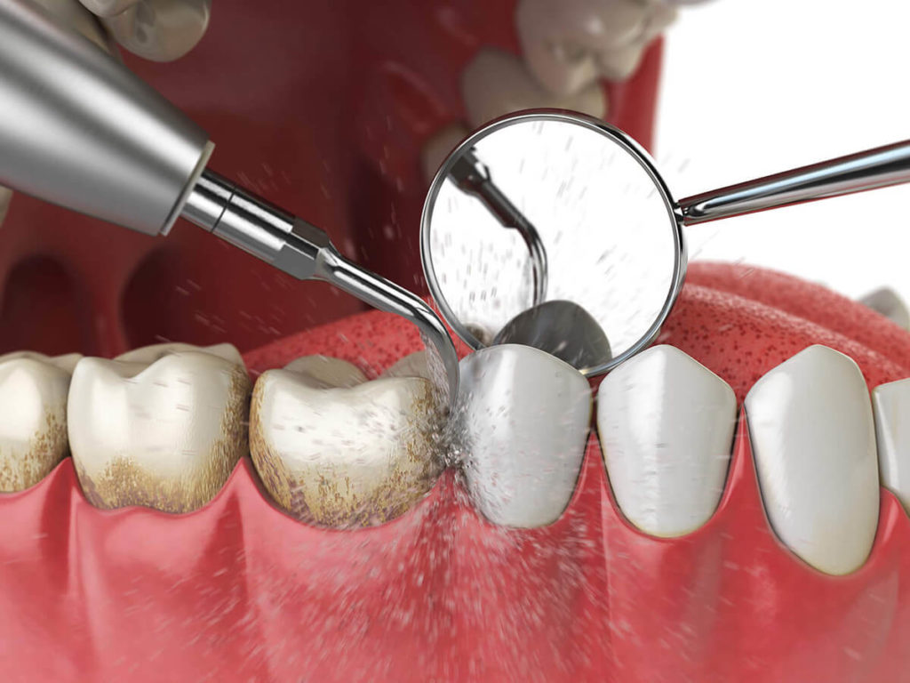 Making Dental Care Affordable While Saving Smiles From Serious Pain
