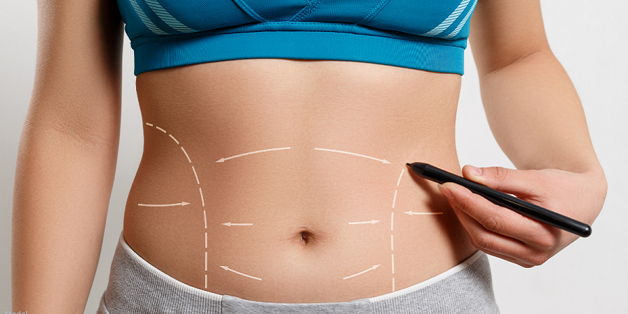 Comprehensive Guide to Abdominoplasty in Jeddah