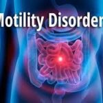 Understanding Esophageal Motility Disorders: Symptoms, Risks, and Management