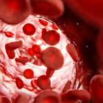 Understanding High Cholesterolemia Dubai: Symptoms and Risks